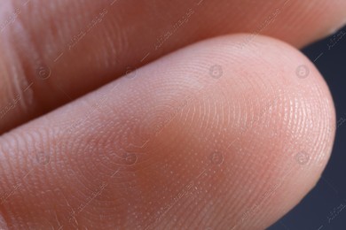 Macro view of finger with friction ridges Photo of Macro view of finger with friction ridges