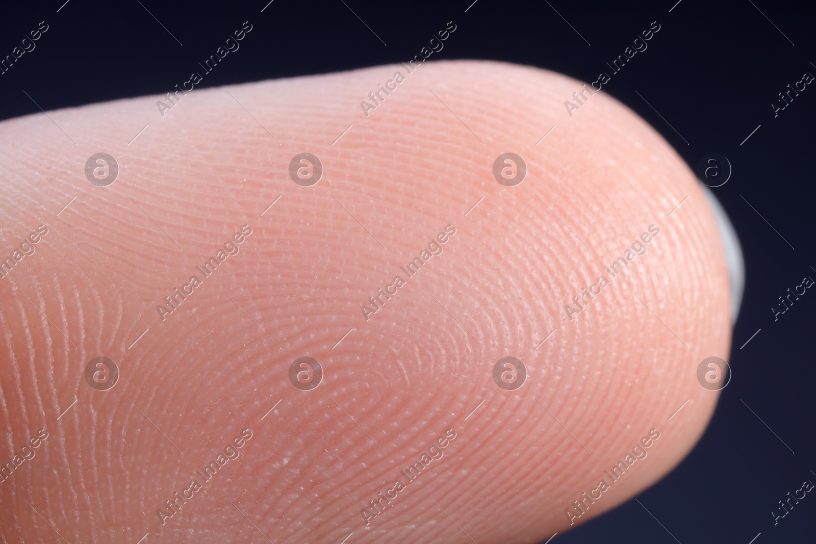 Finger with friction ridges on dark background, macro view Photo of Finger with friction ridges on dark background, macro view