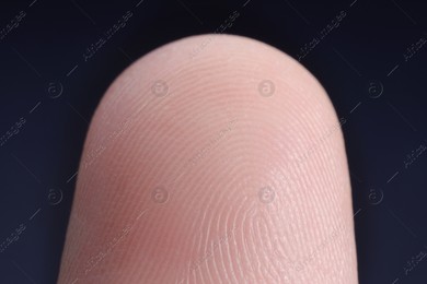 Finger with friction ridges on dark background, macro view Photo of Finger with friction ridges on dark background, macro view