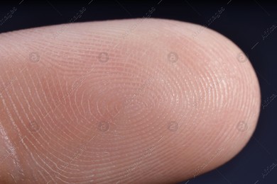 Finger with friction ridges on dark background, macro view Photo of Finger with friction ridges on dark background, macro view