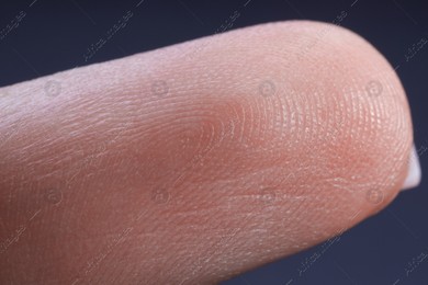 Finger with friction ridges on dark background, macro view Photo of Finger with friction ridges on dark background, macro view