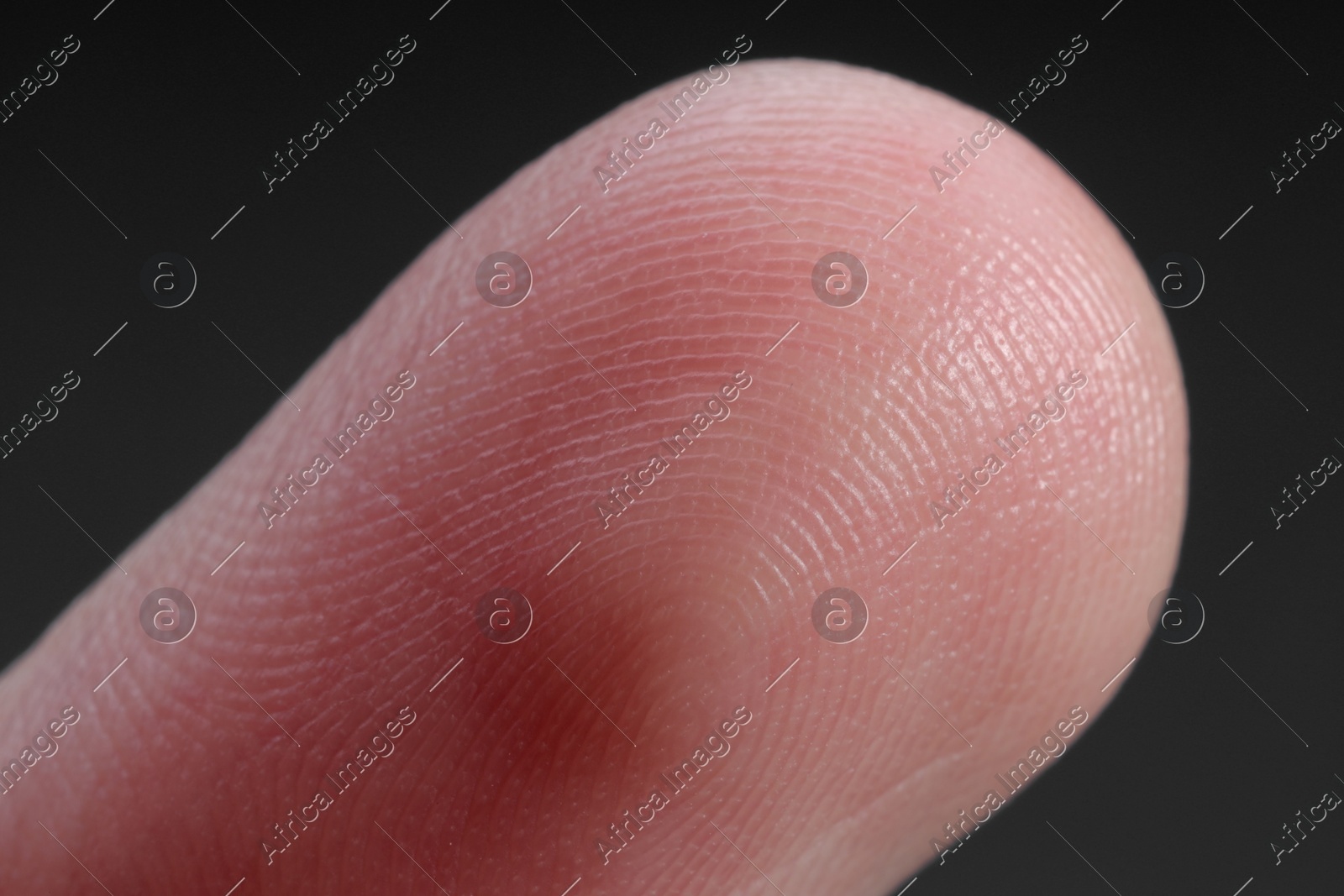 Finger with friction ridges on dark background, macro view Photo of Finger with friction ridges on dark background, macro view
