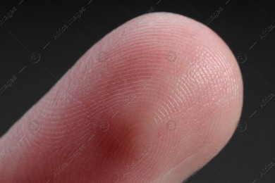 Finger with friction ridges on dark background, macro view Photo of Finger with friction ridges on dark background, macro view