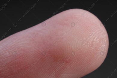 Finger with friction ridges on dark background, macro view Photo of Finger with friction ridges on dark background, macro view