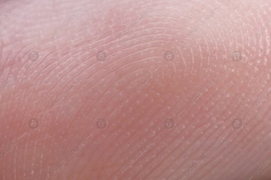 Friction ridges on finger as background, macro view Photo of Friction ridges on finger as background, macro view