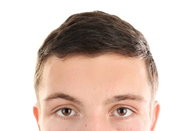 Young man with acne problem on white background Photo of Young man with acne problem on white background