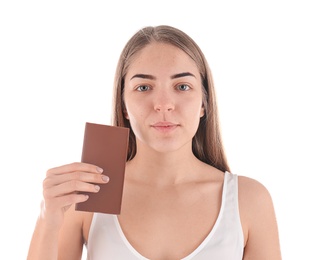 Young woman with acne problem holding chocolate bar on white background. Skin allergy Photo of Young woman with acne problem holding chocolate bar on white background. Skin allergy