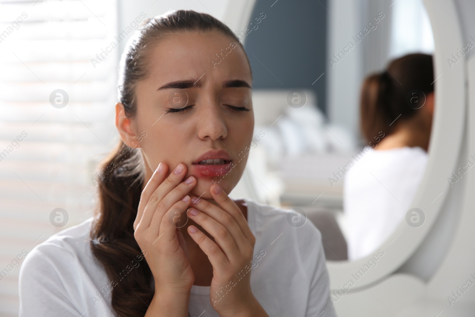 Young woman with herpes on lip at home Photo of Young woman with herpes on lip at home