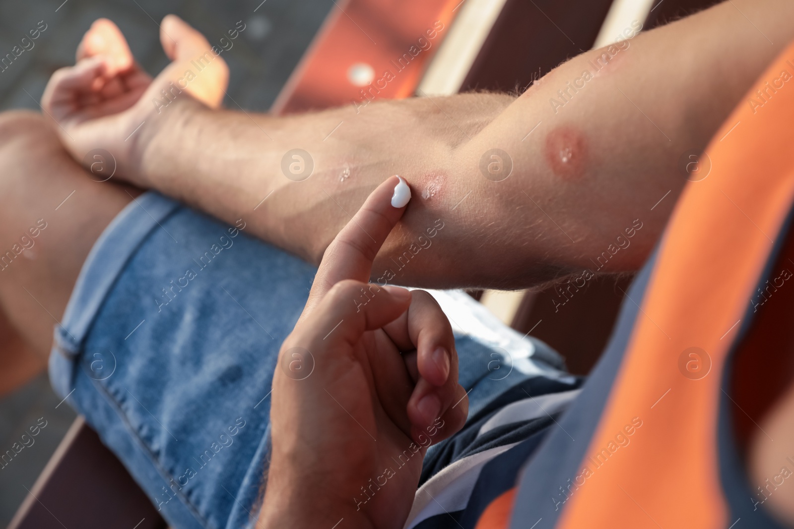 Man applying insect repellent cream on his arm outdoors, closeup Photo of Man applying insect repellent cream on his arm outdoors, closeup