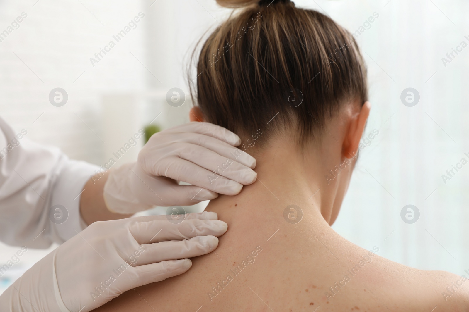 Dermatologist examining patient's birthmark in clinic, closeup Photo of Dermatologist examining patient's birthmark in clinic, closeup