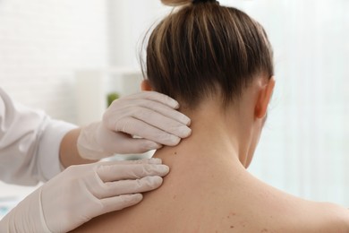Dermatologist examining patient's birthmark in clinic, closeup Photo of Dermatologist examining patient's birthmark in clinic, closeup