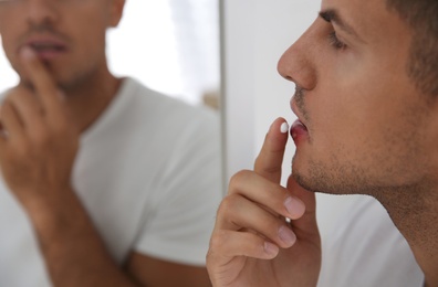 Man with herpes applying cream on lips in front of mirror, closeup Photo of Man with herpes applying cream on lips in front of mirror, closeup
