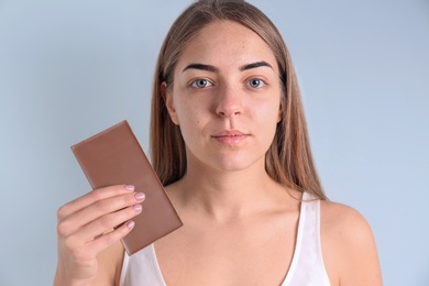 Young woman with acne problem holding chocolate bar on light background. Skin allergy Photo of Young woman with acne problem holding chocolate bar on light background. Skin allergy