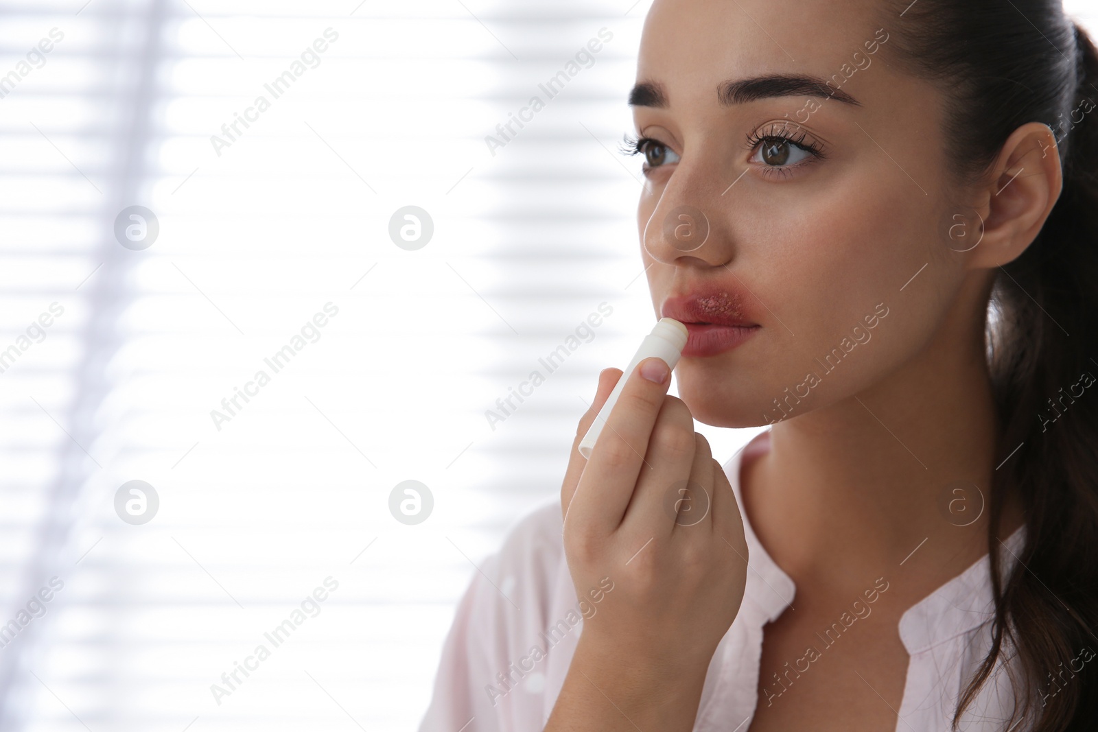 Young woman with herpes applying lip balm against light background. Space for text Photo of Young woman with herpes applying lip balm against light background. Space for text